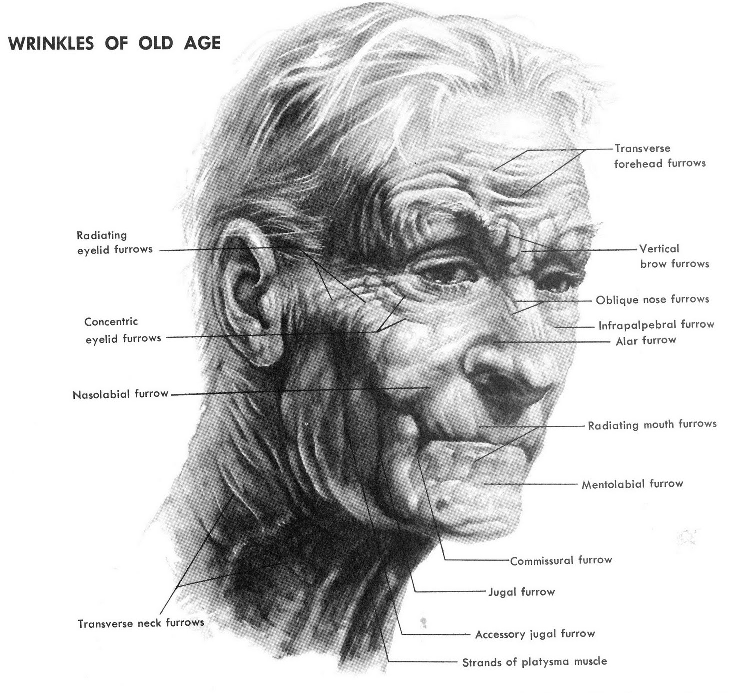 wrinklesofoldage