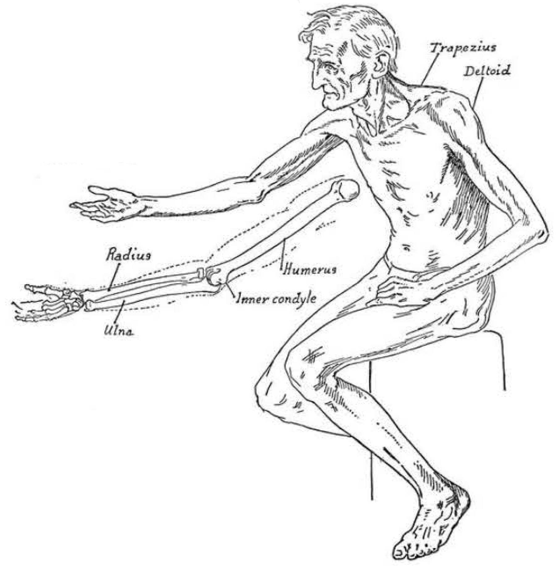 drawing of an old man's body